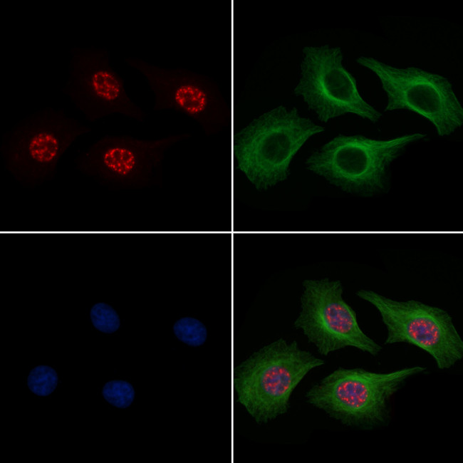 Phospho-SOX2 (Ser249, Ser250) Antibody in Immunocytochemistry (ICC/IF)