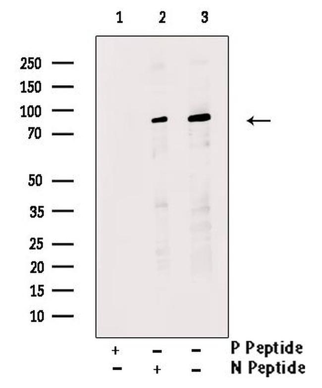 Phospho-Nephrin (Tyr1176) Antibody in Western Blot (WB)