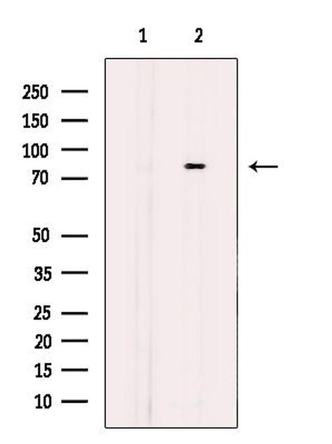 CTNNAL1 Antibody in Western Blot (WB)