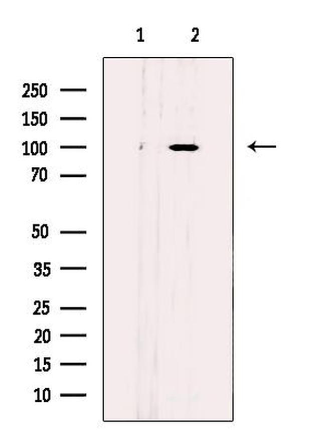 ARHGAP42 Antibody in Western Blot (WB)