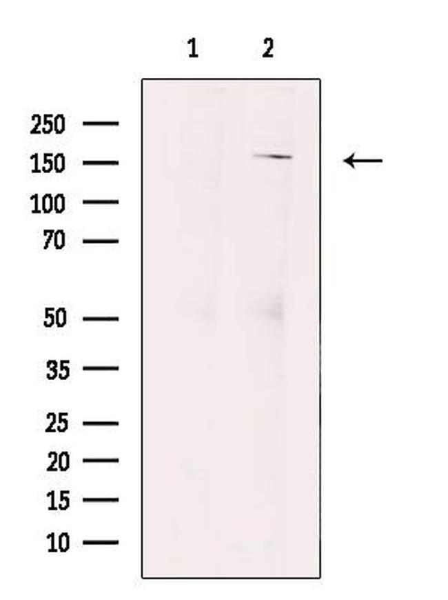 FANCA Antibody in Western Blot (WB)