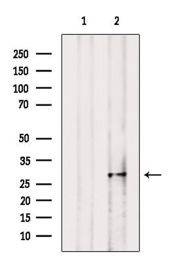 MPZL1 Antibody in Western Blot (WB)