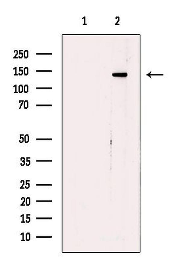 TBC1D1 Antibody in Western Blot (WB)