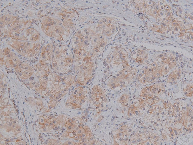 Phospho-BACE1 (Ser498) Antibody in Immunohistochemistry (Paraffin) (IHC (P))
