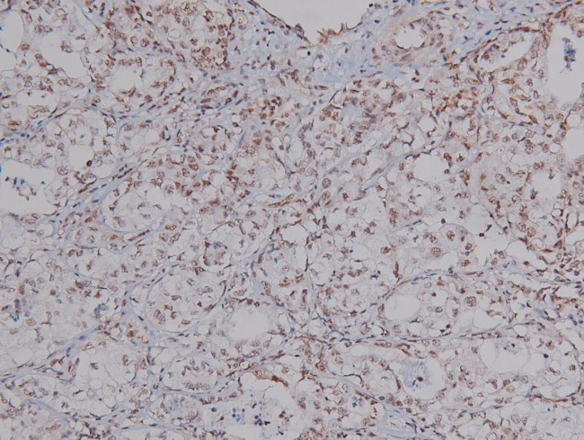 Phospho-CtIP (Ser327) Antibody in Immunohistochemistry (Paraffin) (IHC (P))
