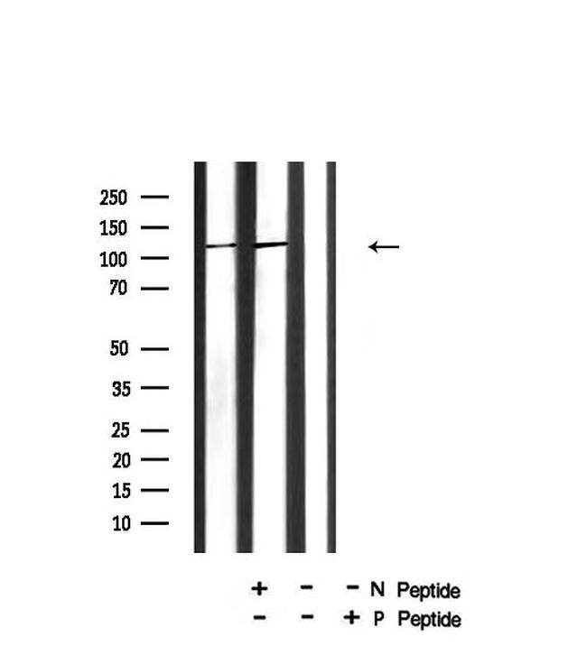Phospho-c-Cbl (Tyr731) Antibody in Western Blot (WB)