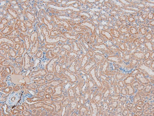Phospho-CD31 (Tyr690) Antibody in Immunohistochemistry (Paraffin) (IHC (P))