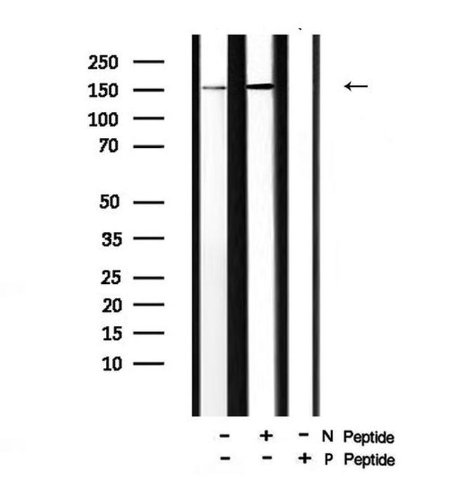 Phospho-PLCG2 (Tyr759) Antibody in Western Blot (WB)
