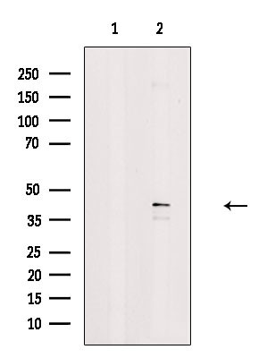 Phospho-RAD9 (Ser272) Antibody in Western Blot (WB)