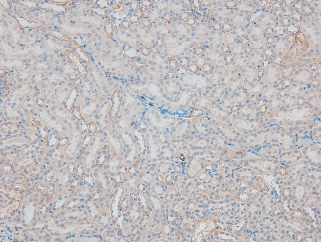 Phospho-FES (Tyr713) Antibody in Immunohistochemistry (Paraffin) (IHC (P))