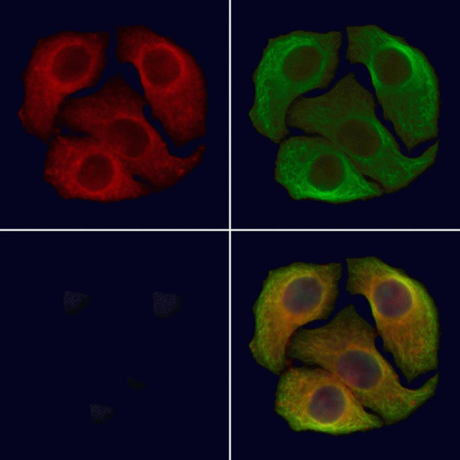 Phospho-DAPK1 (Ser308) Antibody in Immunocytochemistry (ICC/IF)
