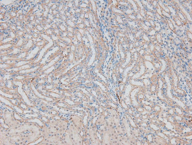 Phospho-ErbB2 (HER-2) (Thr686) Antibody in Immunohistochemistry (Paraffin) (IHC (P))