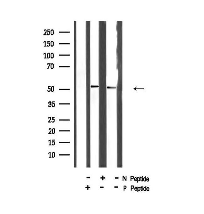 Phospho-SMAD2 (Ser245) Antibody in Western Blot (WB)