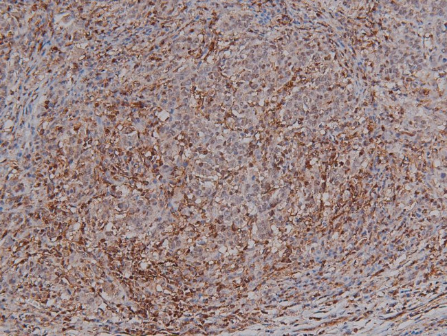 Phospho-HMGN2 (Ser29) Antibody in Immunohistochemistry (Paraffin) (IHC (P))
