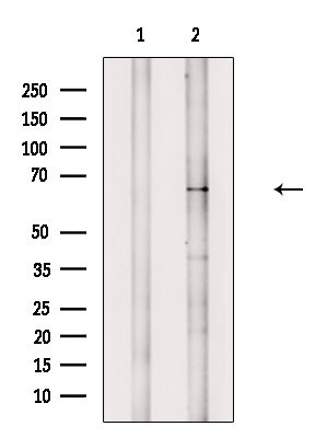 Phospho-IL1R1 (Tyr496) Antibody in Western Blot (WB)