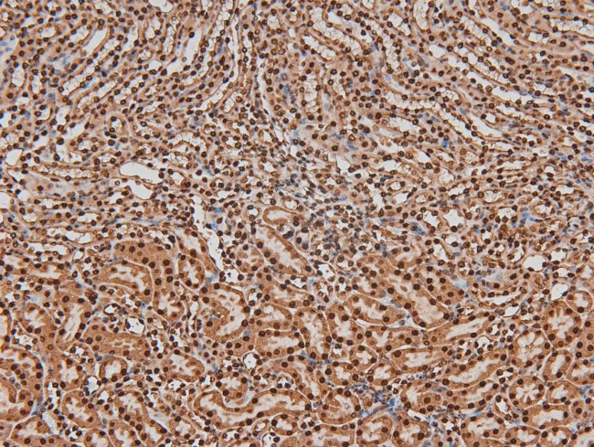 Phospho-ITK (Tyr512) Antibody in Immunohistochemistry (Paraffin) (IHC (P))