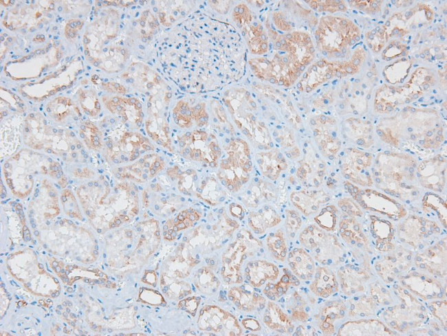 Phospho-MAX (Ser2) Antibody in Immunohistochemistry (Paraffin) (IHC (P))