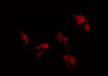 Phospho-eNOS (Ser1179) Antibody in Immunocytochemistry (ICC/IF)