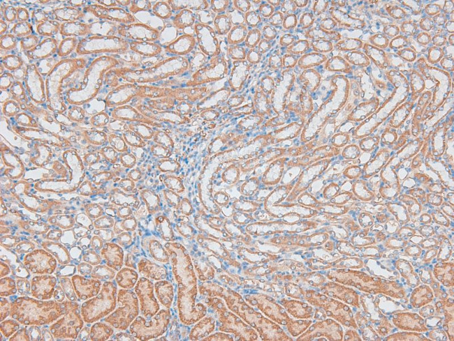 Phospho-DNA ligase IV (Thr650) Antibody in Immunohistochemistry (Paraffin) (IHC (P))