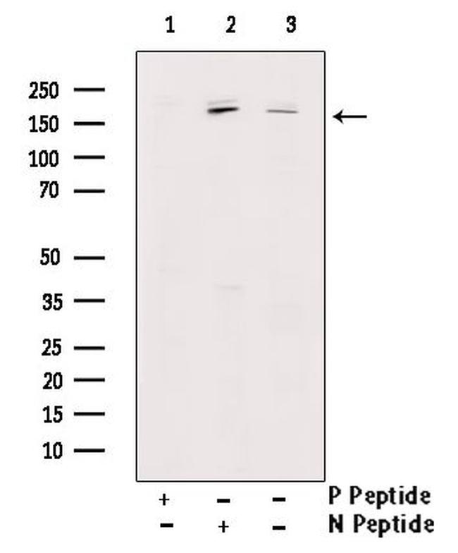 Phospho-TOP2A (Ser1213) Antibody in Western Blot (WB)