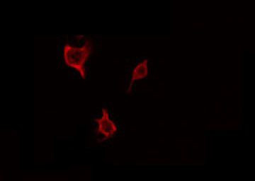 Phospho-ASK1 (Thr838) Antibody in Immunocytochemistry (ICC/IF)