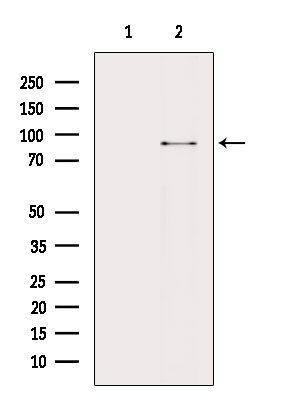 Phospho-beta Catenin (Tyr142) Antibody in Western Blot (WB)