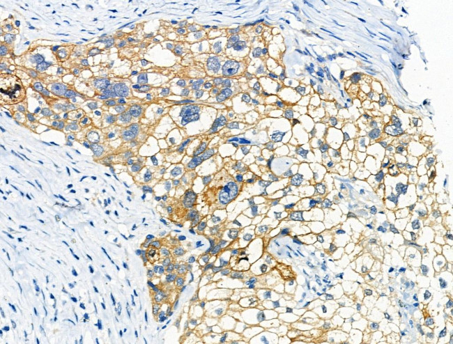 Phospho-beta Catenin (Ser675) Antibody in Immunohistochemistry (Paraffin) (IHC (P))