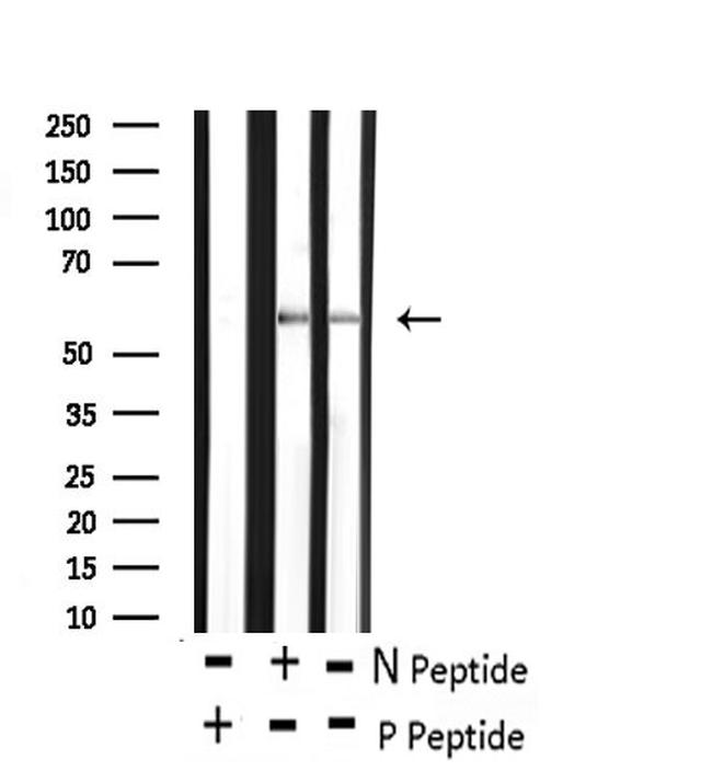 Phospho-CDC25A (Ser82) Antibody in Western Blot (WB)