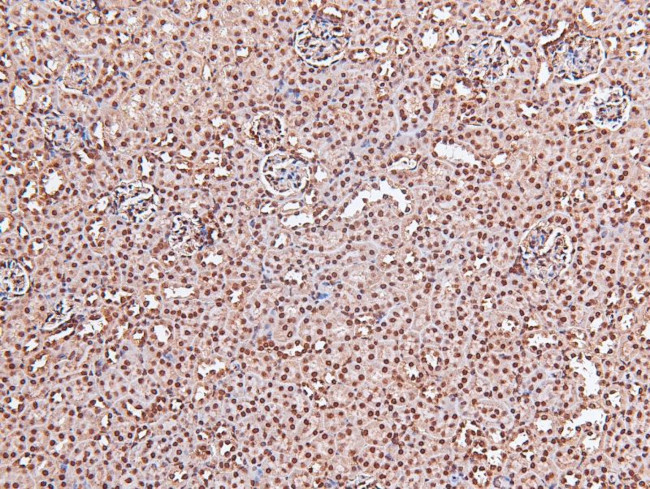 Phospho-EGFR (Tyr998) Antibody in Immunohistochemistry (Paraffin) (IHC (P))