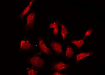 Phospho-eNOS (Ser114) Antibody in Immunocytochemistry (ICC/IF)