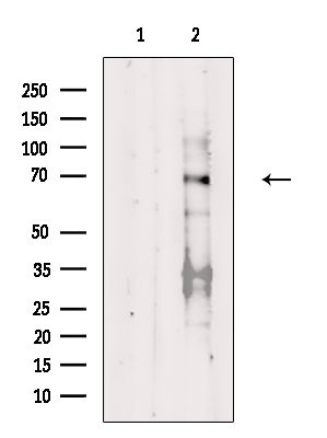 Phospho-Estrogen Receptor alpha (Thr311) Antibody in Western Blot (WB)