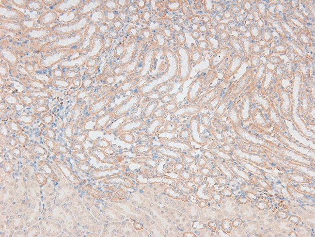 Phospho-FOXO3A (Ser315) Antibody in Immunohistochemistry (Paraffin) (IHC (P))