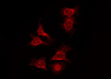 Phospho-FOXO4 (Thr455) Antibody in Immunocytochemistry (ICC/IF)