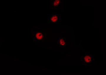 Phospho-p53 (Thr55) Antibody in Immunocytochemistry (ICC/IF)