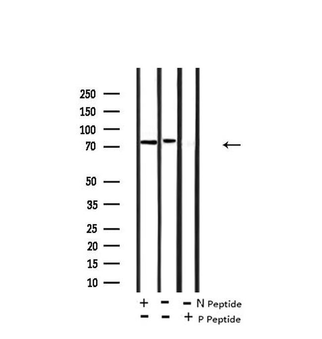 Phospho-Tau (Ser717, Ser400) Antibody in Western Blot (WB)