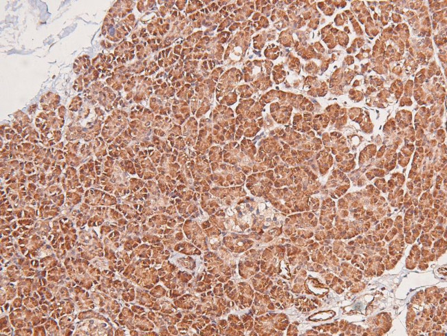 Phospho-BLK (Tyr389) Antibody in Immunohistochemistry (Paraffin) (IHC (P))