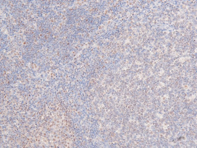 Phospho-CDK1 (Thr161) Antibody in Immunohistochemistry (Paraffin) (IHC (P))