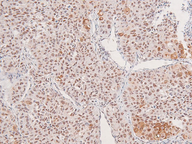 Phospho-DAPK1 (Ser734) Antibody in Immunohistochemistry (Paraffin) (IHC (P))