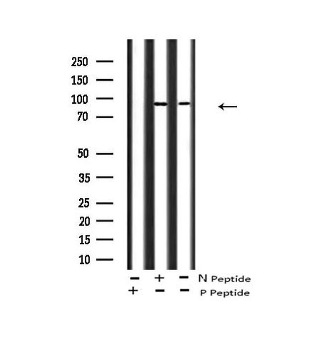 Phospho-FGFR3 (Tyr760) Antibody in Western Blot (WB)