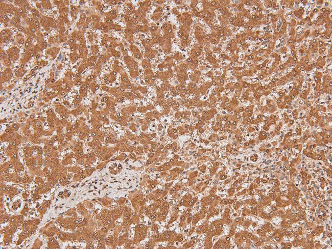 Phospho-FLT3 (Tyr591) Antibody in Immunohistochemistry (Paraffin) (IHC (P))