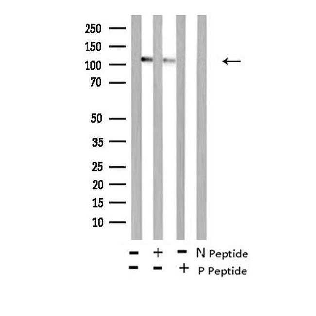 Phospho-FLT3 (Tyr589) Antibody in Western Blot (WB)