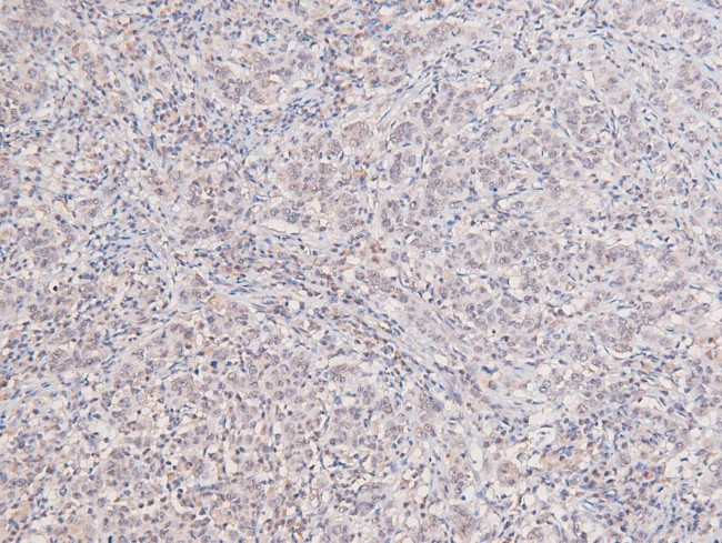 Phospho-c-Kit (Tyr568) Antibody in Immunohistochemistry (Paraffin) (IHC (P))