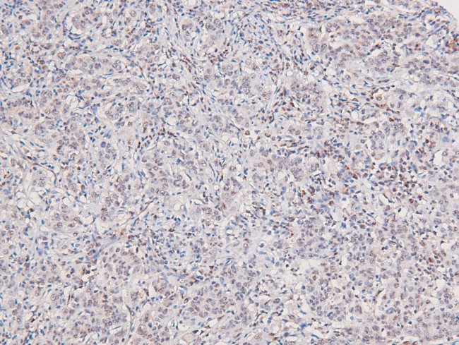 Phospho-c-Kit (Ser746) Antibody in Immunohistochemistry (Paraffin) (IHC (P))