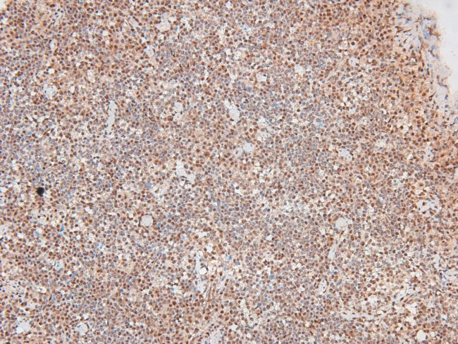 Phospho-MAP2K1/MAP2K2 (Ser212, Ser216) Antibody in Immunohistochemistry (Paraffin) (IHC (P))