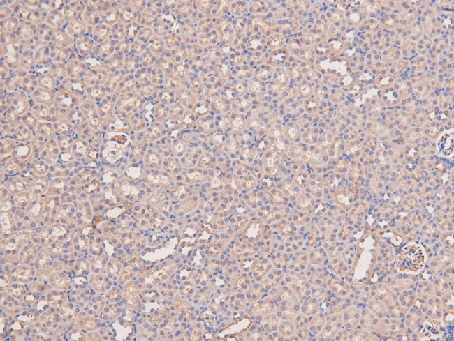 Phospho-MEKK2 (Ser520) Antibody in Immunohistochemistry (Paraffin) (IHC (P))