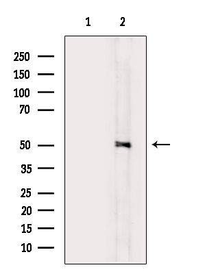 Phospho-MEK5 (Ser311) Antibody in Western Blot (WB)