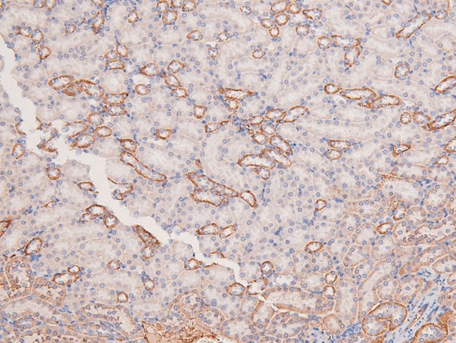 Phospho-MOK (Tyr161) Antibody in Immunohistochemistry (Paraffin) (IHC (P))