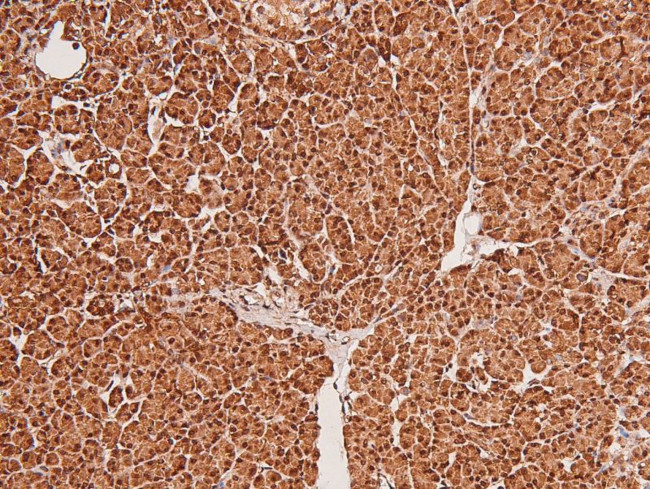 Phospho-MSK2 (Ser196) Antibody in Immunohistochemistry (Paraffin) (IHC (P))