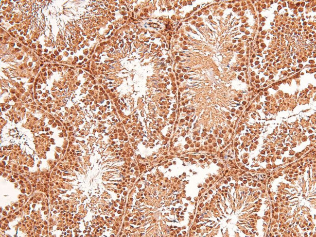 Phospho-TTK (Thr676) Antibody in Immunohistochemistry (Paraffin) (IHC (P))