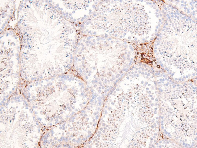 Phospho-PDGFRA (Tyr720) Antibody in Immunohistochemistry (Paraffin) (IHC (P))